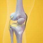 Knee Replacement Surgery Cost in India 2026